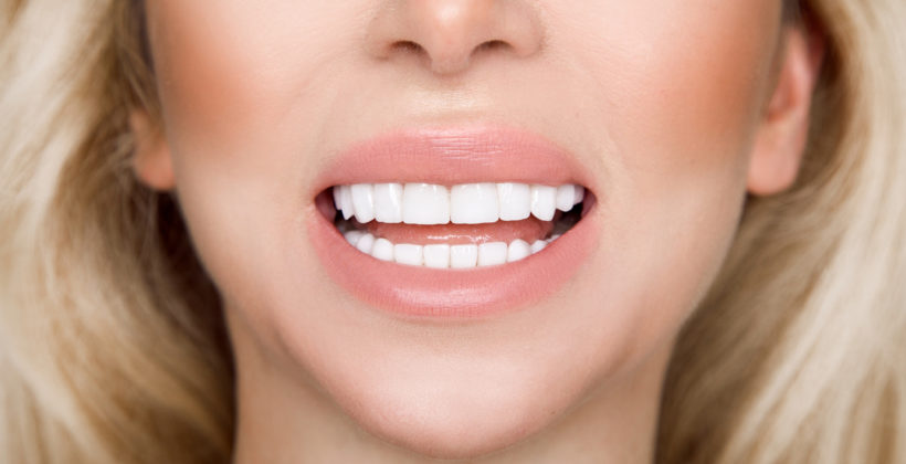 close up of woman's teeth after teeth whitening