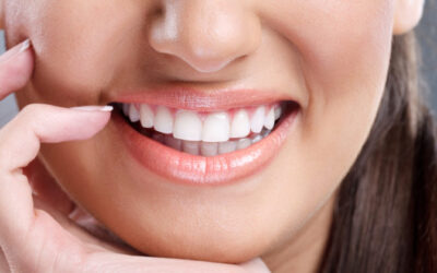 4 Reasons Porcelain Veneers Are Awesome