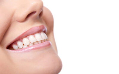 How Can I Improve My Smile with Dental Care?