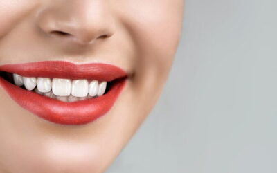 Why should I consider dental veneers?