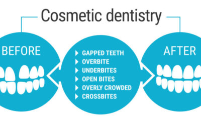 Cosmetic Dentistry: Services and Benefits