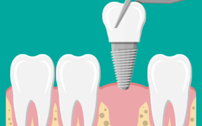 Does gum disease prevent you from getting dental implants?