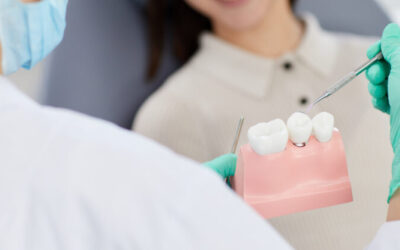 Dental Crown Types: Cost Comparison
