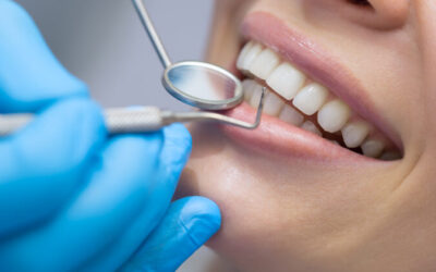 General Dentist vs Orthodontist: Who should I call?