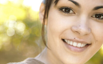 Try Icon Teeth Treatment to Remove Embarrassing White Spots