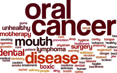 Oral Cancer Screening: Frequently Asked Questions