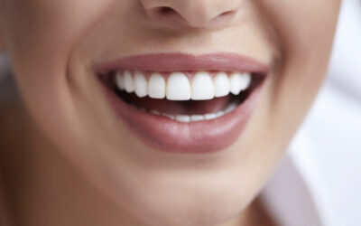 Top 3 Cosmetic Dentistry Options: Veneers, Teeth Whitening, & Invisalign®
