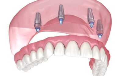 Part 2: Lombard Dentist Offers Gentle Geriatric Dentistry