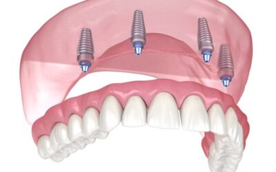 Part 2: Lombard Dentist Offers Gentle Geriatric Dentistry