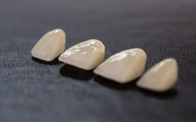 “How long do they last?” and Other FAQs about Dental Crowns