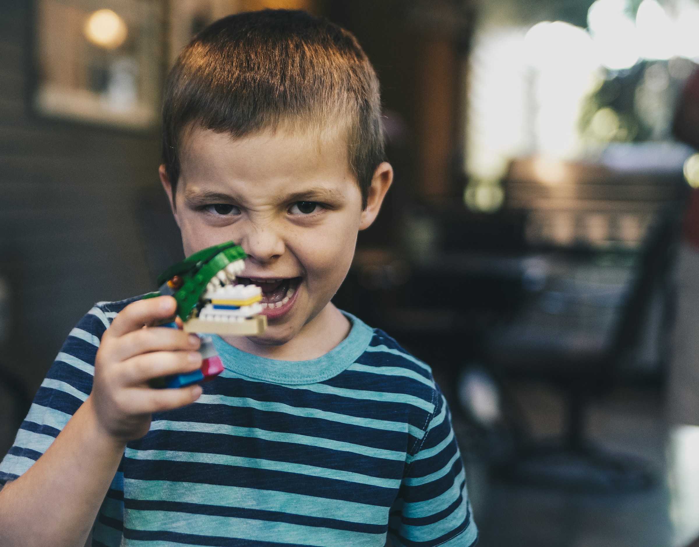 little boy with baby teeth holding a teeth mold