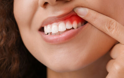 Gum Disease and Diabetes: What Your Dentist in Lombard, IL, Wants You to Know