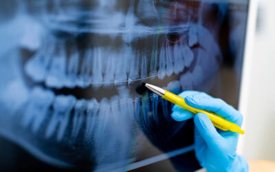 The Role of Technology in Modern Dentistry in Lombard