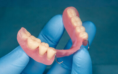 The Future of Partial Dentures: Lightweight, Durable, and More Natural