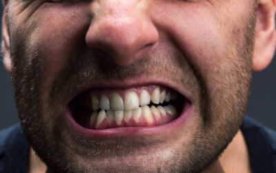 Ask a Dentist in Lombard, IL: How Do I Stop Grinding My Teeth?