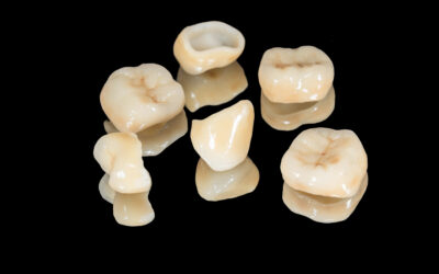 Metal-Free Dental Crowns: Are They Strong Enough?
